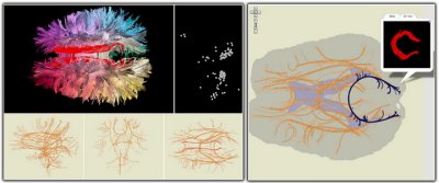 Ученые реализовали метод визуализации мозга «а-ля Google Maps»
