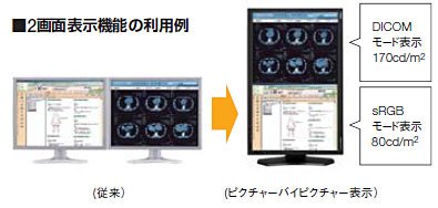 NEC   24,1"  MultiSync MD242C2